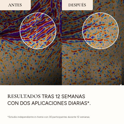Antes y después: resultados tras 12 semanas