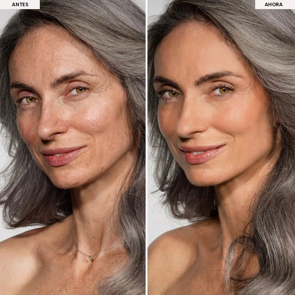 sg-gallery-7-before-after